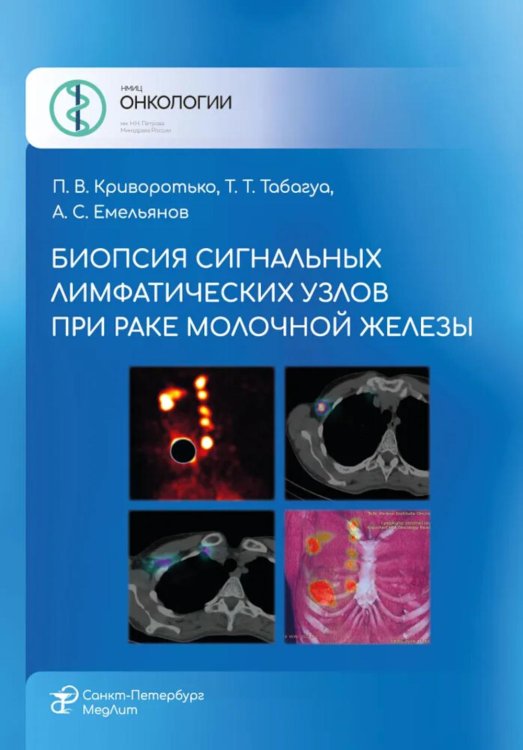 Биопсия сигнальных лимфатических узлов при раке молочной железы Биопсия сигнальных лимфатических узлов при раке молочной железы