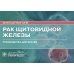 Рак щитовидной железы: руководство для врачей