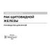 Рак щитовидной железы: руководство для врачей