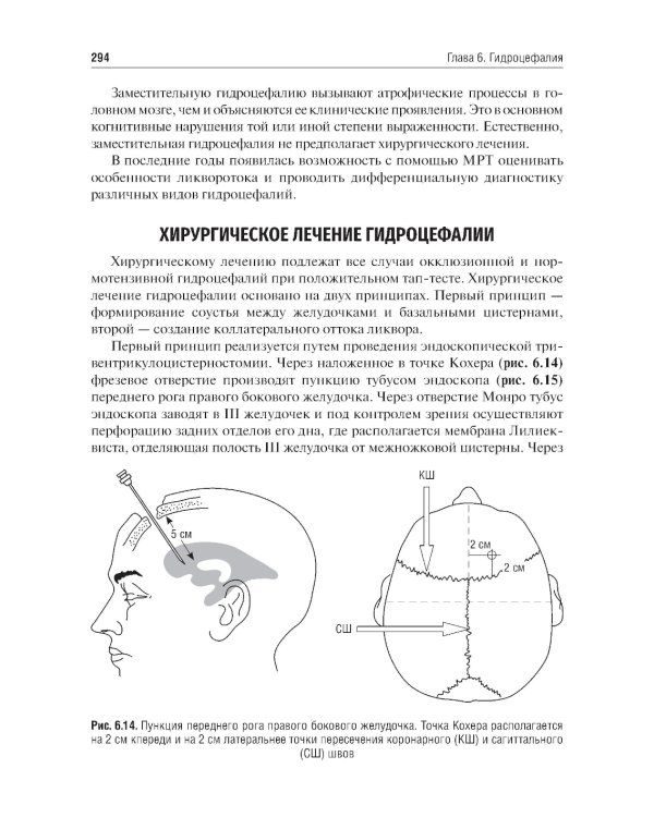 Основы нейрохирургии: Учебное пособие
