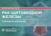 Рак щитовидной железы: руководство для врачей