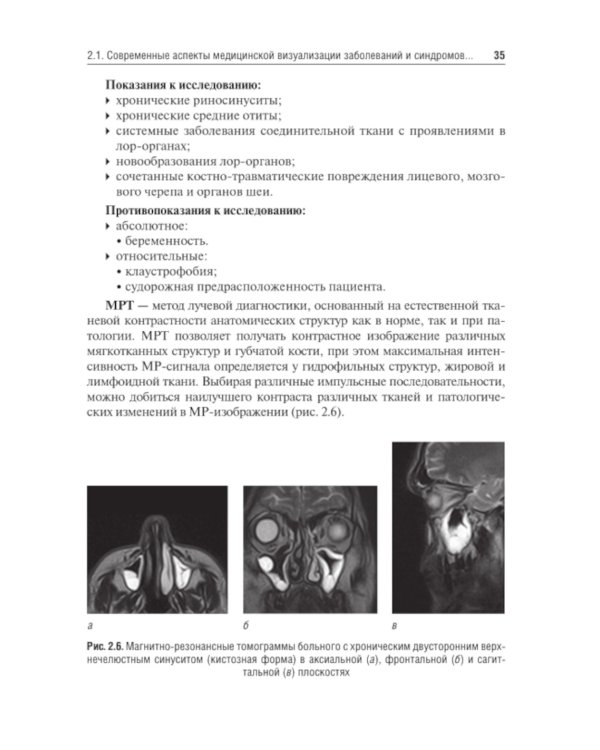 Оториноларингология: Учебник. 2-е изд., перераб. и доп