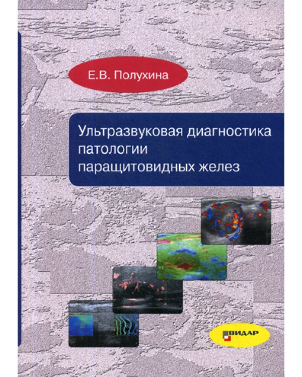 Ультразвуковая диагностика патологии паращитовидных желез