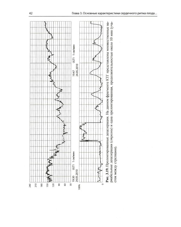 Кардиотокография при беременности и в родах. 8-е изд