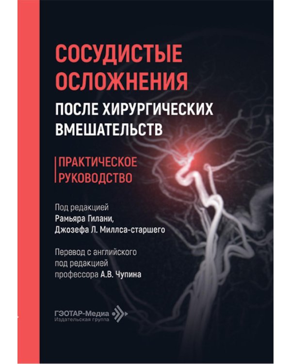 Сосудистые осложнения после хирургических вмешательств. Практическое руководство