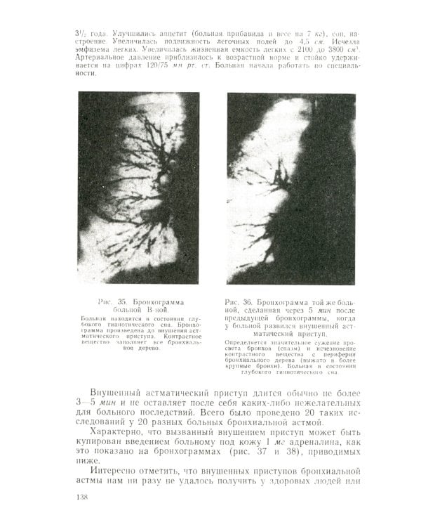 Гипноз в клинике внутренних болезней. Опыт психотерапии — гипноза и внушения в клинике