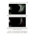 Практическая офтальмология УЗИ в офтальмологии