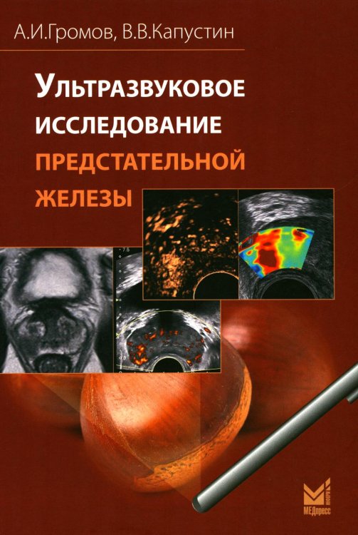 Ультразвуковое исследование предстательной железы