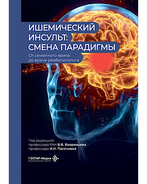 Ишемический инсульт: смена парадигмы (от семейного врача до врача-реабилитолога)