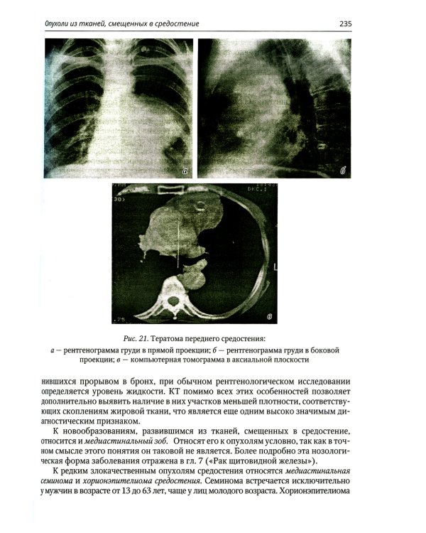 Клиническая онкология груди и живота: руководство для врачей