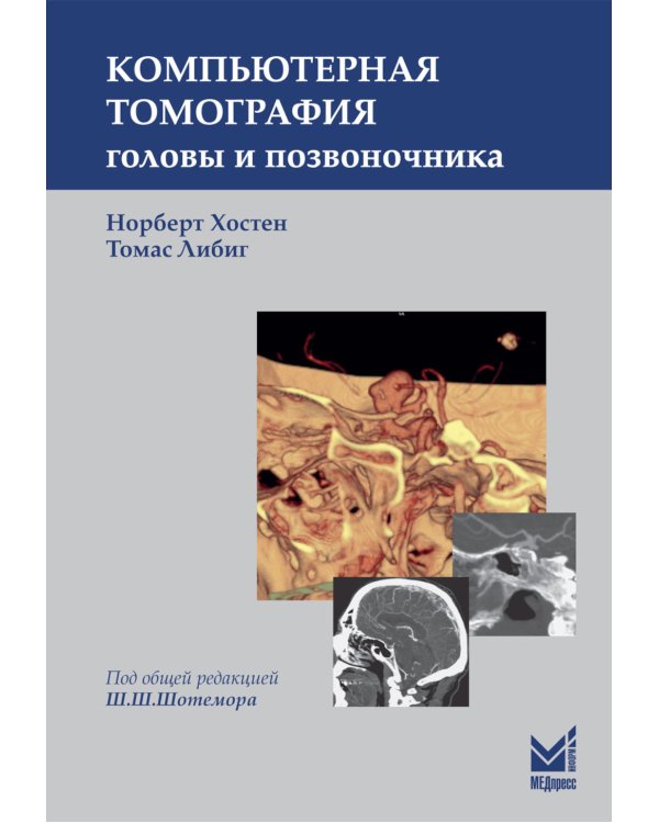 Компьютерная томография головы и позвоночника. 3-е изд