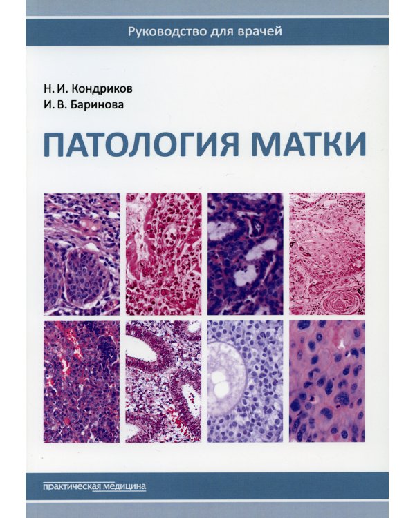 Патология матки. Руководство для врачей. 2-е изд