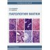 Патология матки. Руководство для врачей. 2-е изд