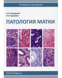 Патология матки. Руководство для врачей. 2-е изд