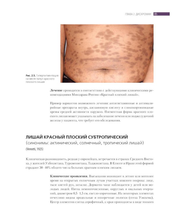 Дифференциальная диагностика и лечение кожных болезней. Атлас-справочник. 2-е изд., пер