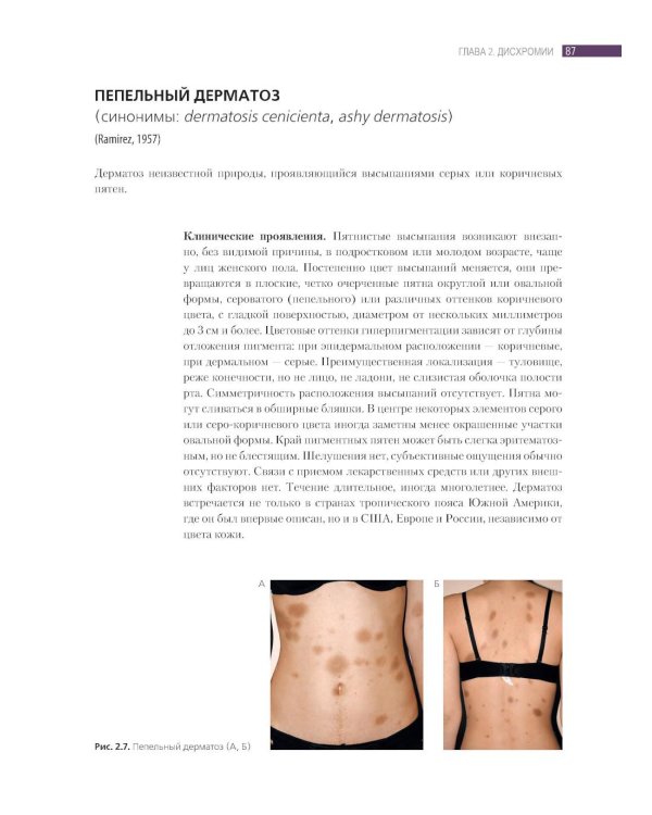 Дифференциальная диагностика и лечение кожных болезней. Атлас-справочник. 2-е изд., пер