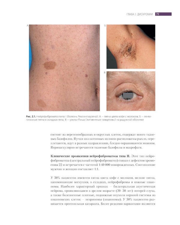 Дифференциальная диагностика и лечение кожных болезней. Атлас-справочник. 2-е изд., пер