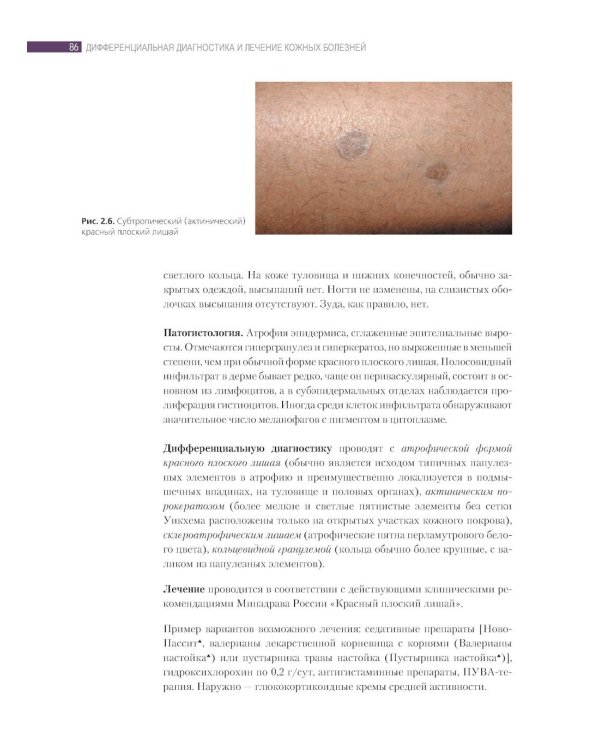 Дифференциальная диагностика и лечение кожных болезней. Атлас-справочник. 2-е изд., пер