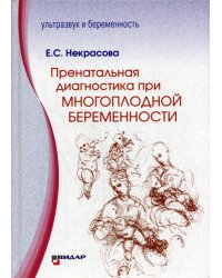 Пренатальная диагностика при многоплодной беременности