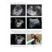 Ультразвуковое исследование при экстренных и неотложных состояниях