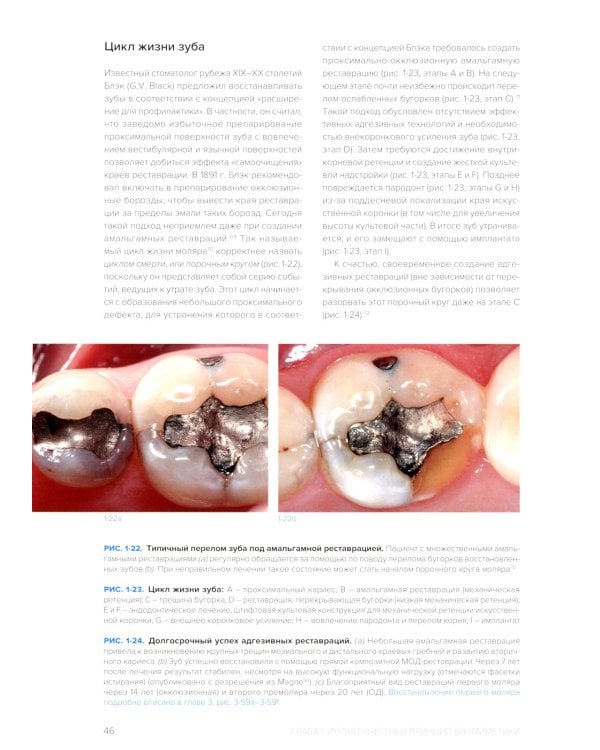 Биомиметика в реставрационной стоматологии. В 2 т