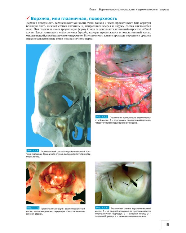 Атлас анатомии зубочелюстной системы для имплантологов. 3-е изд