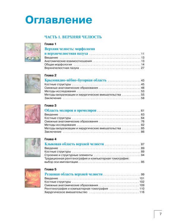 Атлас анатомии зубочелюстной системы для имплантологов. 3-е изд
