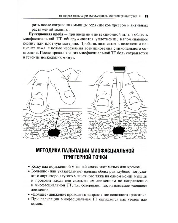 Миофасциальный болевой синдром. Диагностика, подходы к терапии и профилактика: руководство. 2-е изд., перераб.и доп