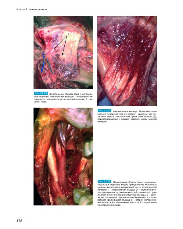 Атлас анатомии зубочелюстной системы для имплантологов. 3-е изд