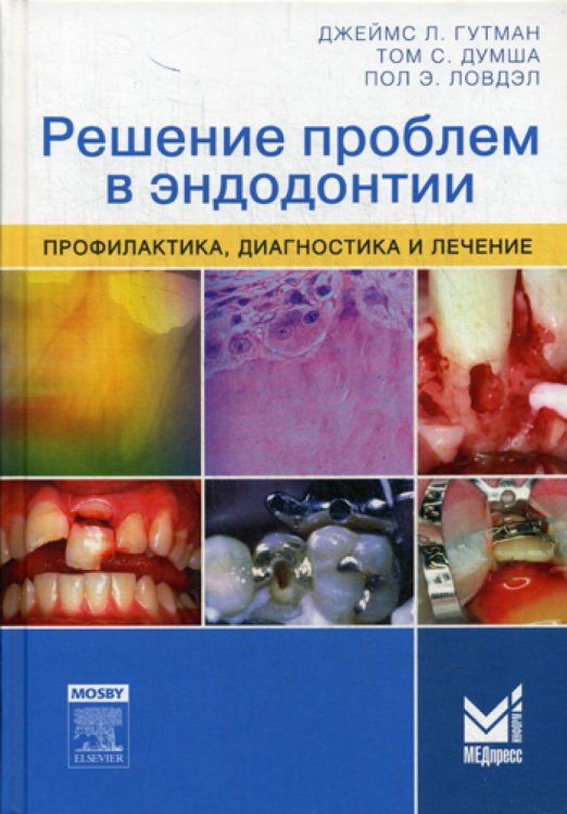 Решение проблем в эндодонтии. Профилактика, диагностика и лечение. 2-е изд Решение проблем в эндодонтии. Профилактика, диагностика и лечение. 2-е изд