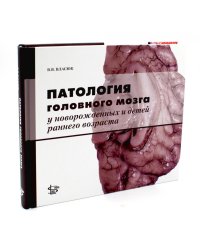 Патология головного мозга у новорожденных и детей раннего возраста