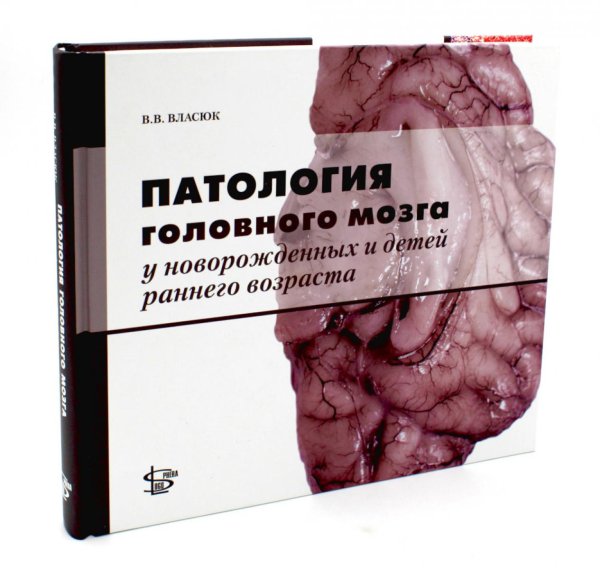 Патология головного мозга у новорожденных и детей раннего возраста Патология головного мозга у новорожденных и детей раннего возраста