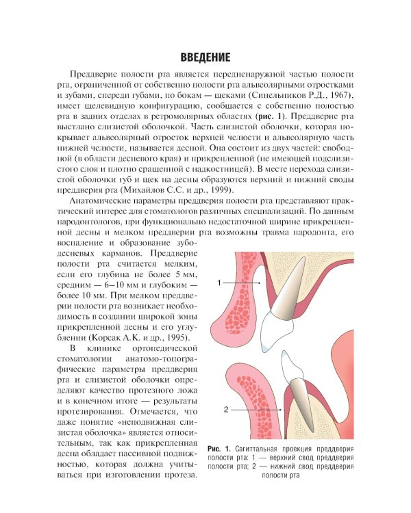 Вестибулопластика: руководство для врачей