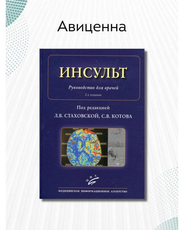 Инсульт. Руководство для врачей