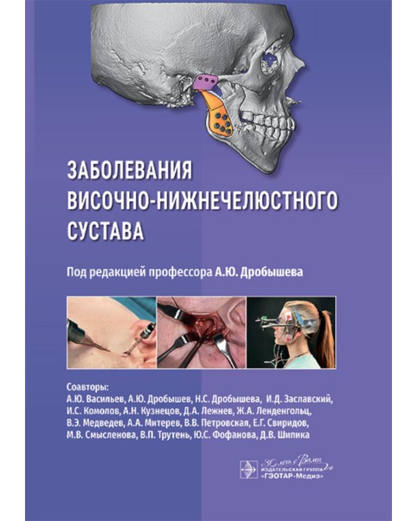 Заболевания височно-нижнечелюстного сустава