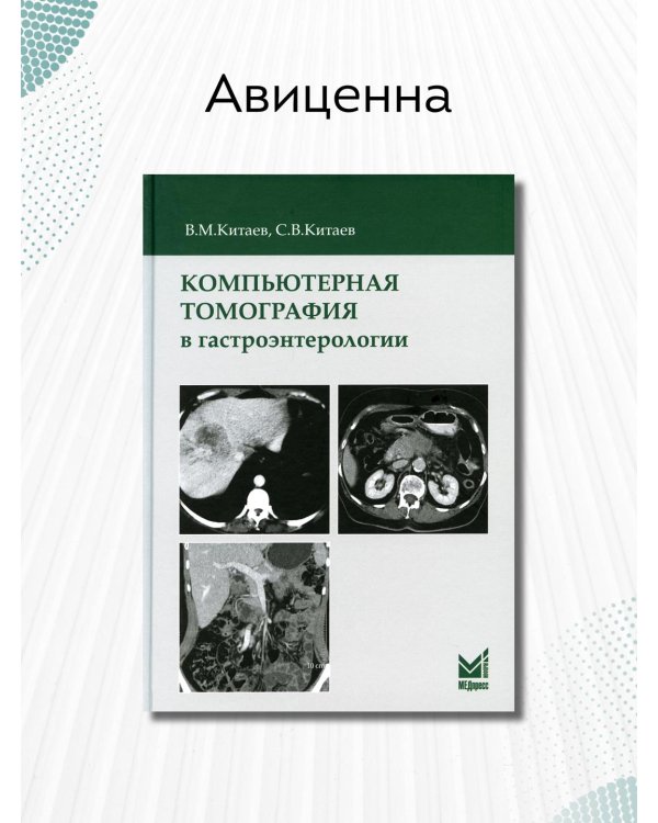 Компьютерная томография в гастроэнтерологии
