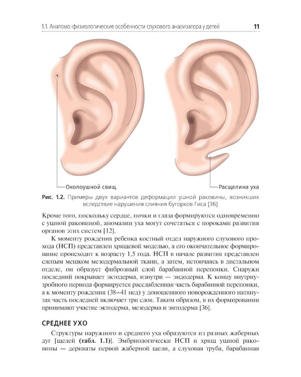 Скрининг слуха у несовершеннолетних: Учебное пособие