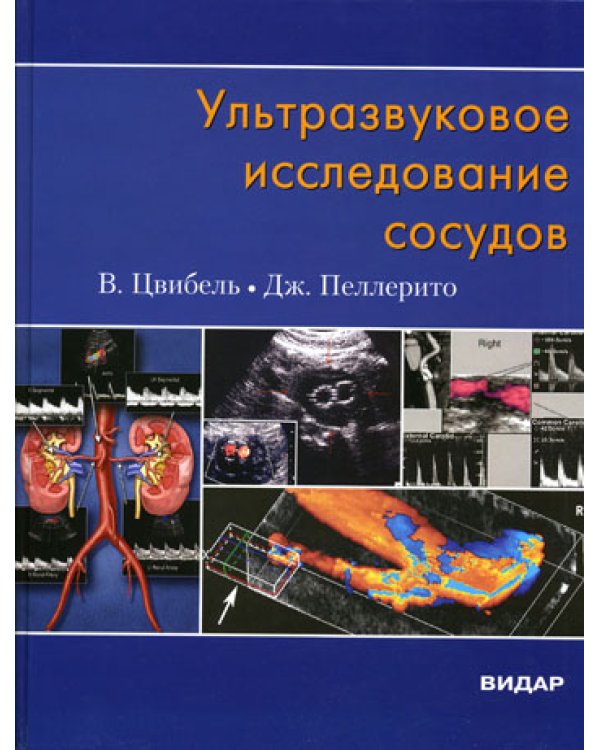Ультразвуковое исследование сосудов. 5-е изд