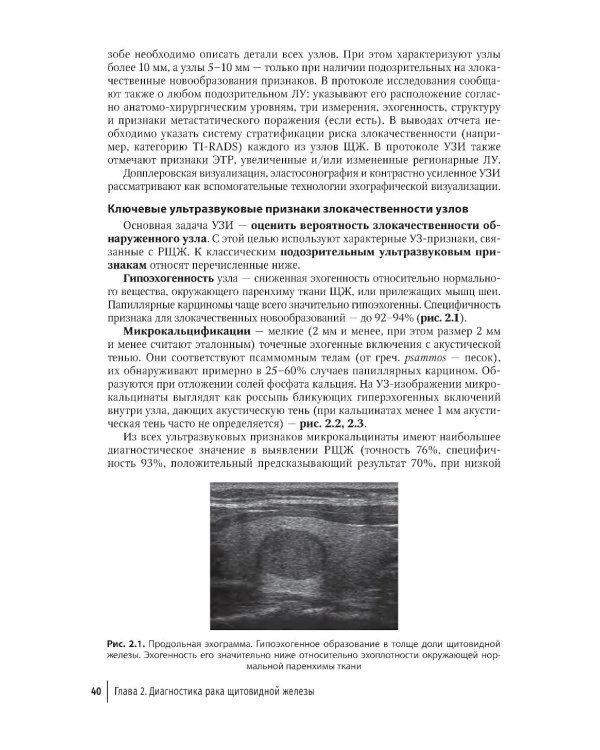 Рак щитовидной железы: руководство для врачей