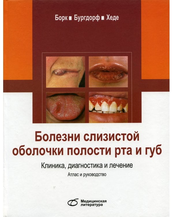 Болезни слизистой оболочки полости рта и губ. Клиника, диагностика и лечение. Атлас и руководство