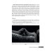 Черно-белые детали оптической когерентной томографии глаза
