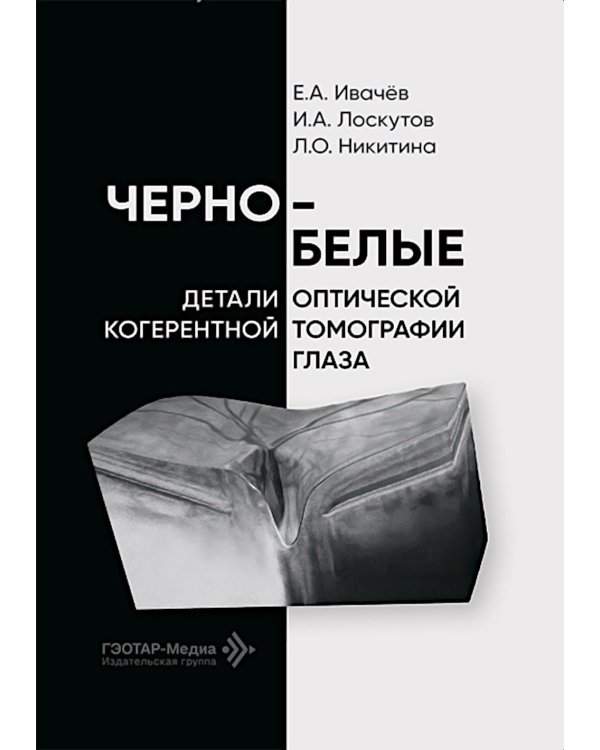 Черно-белые детали оптической когерентной томографии глаза