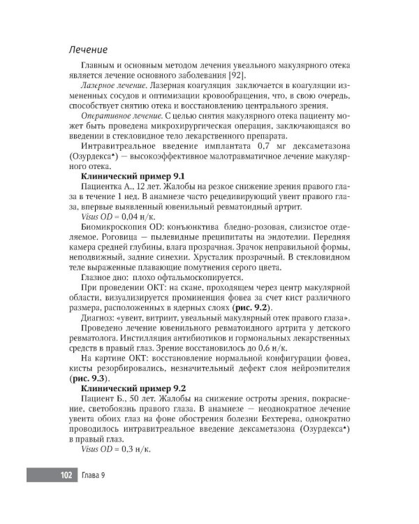 Черно-белые детали оптической когерентной томографии глаза