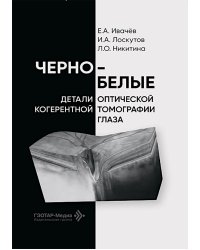 Черно-белые детали оптической когерентной томографии глаза