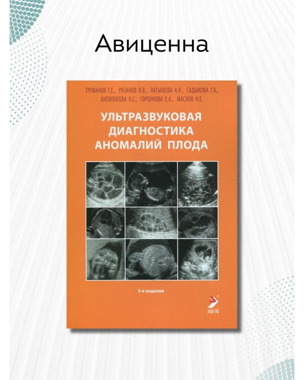 Ультразвуковая диагностика аномалий плода. Руководство для врачей