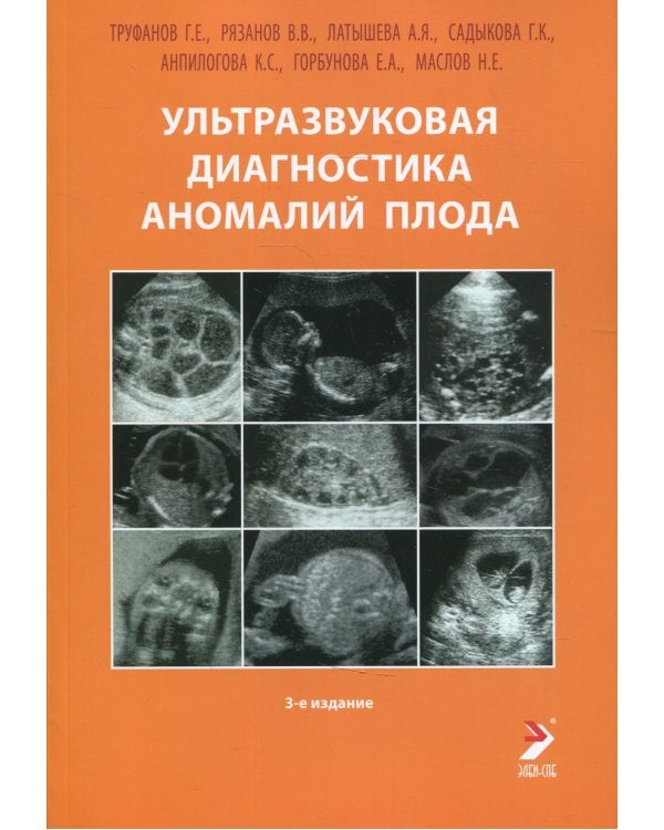 Ультразвуковая диагностика аномалий плода: Руководство для врачей. 3-е изд