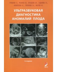 Ультразвуковая диагностика аномалий плода: Руководство для врачей. 3-е изд