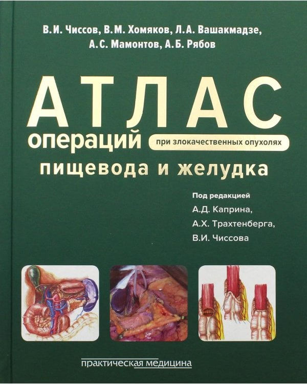 Атлас операций при злокачественных опухолях пищевода и желудка