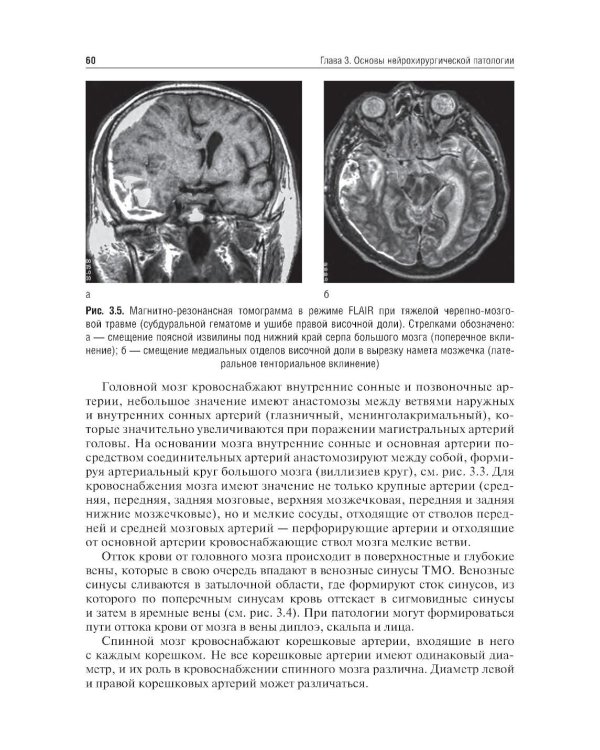 Неврология и нейрохирургия: Учебник. В 2 т. Т. 2: Нейрохирургия. 5-е изд., доп