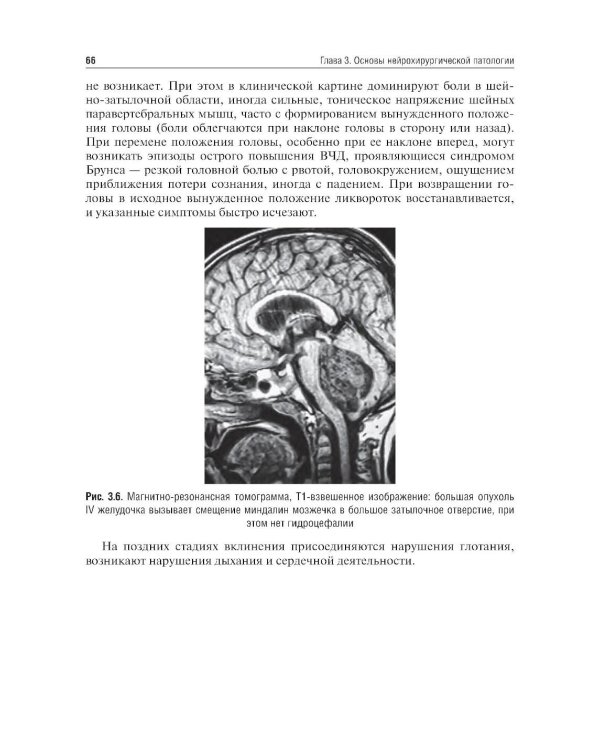 Неврология и нейрохирургия: Учебник. В 2 т. Т. 2: Нейрохирургия. 5-е изд., доп